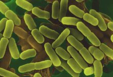 FDA وEverything Sprouts: لا تقارير حالات مرتبطة بالدفعات حتى الآن
