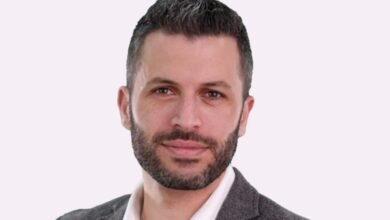 جورج زيادة الإقبال كبير على عمليات شفط دهون الخد
