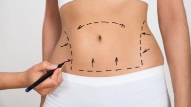 عملية شفط الدهون من منظور جراح التجميل اللبناني علي عبد علي